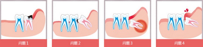长智齿时牙龈肿痛怎么办？